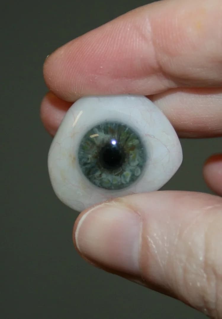 Completed custom prosthesis